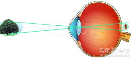 遠視眼不帶眼鏡行不行