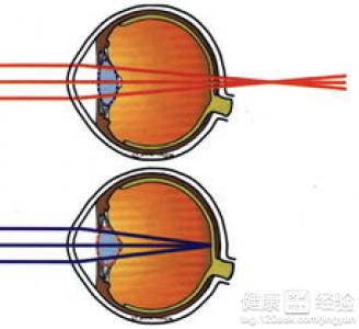 遠視眼造成的原因有哪些呢？
