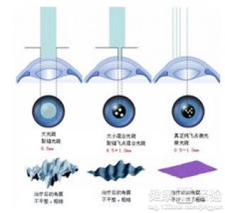 第2步