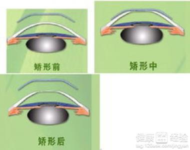 第3步