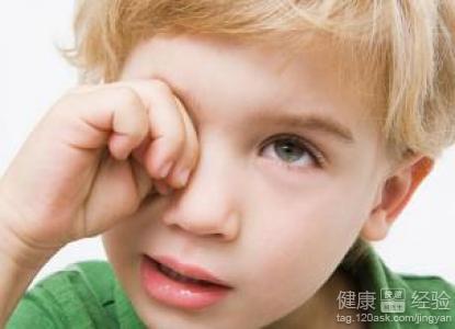 紅眼病危害多引起孩子紅眼病的原因