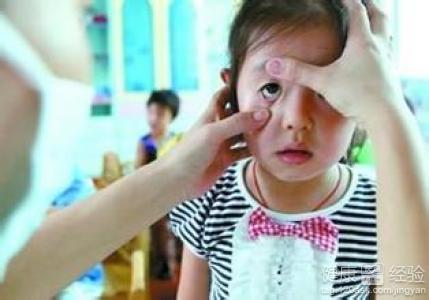 預防紅眼病應避開3大誤區