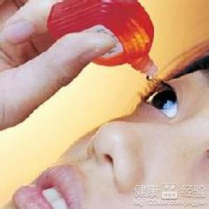 急性結膜炎是紅眼病嗎