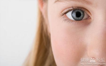 紅眼病怎麼治療偏方