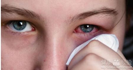 紅眼病一般多久可以康復