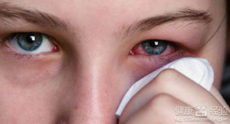 媽媽有紅眼病照顧小孩怎樣才不被感染