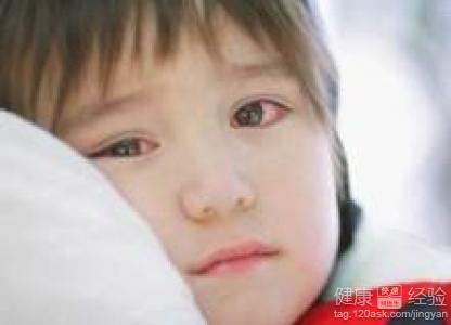 孩子得了紅眼病用藥時要注意什麼