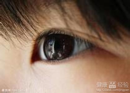 紅眼病該怎麼治？