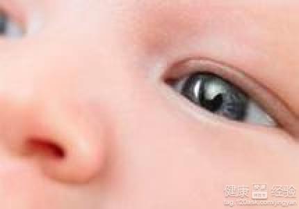 怎麼預防寶寶紅眼病