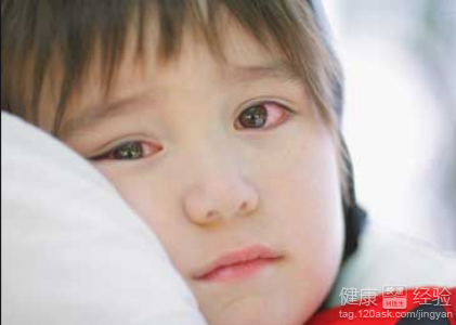 如何有效預防紅眼病？