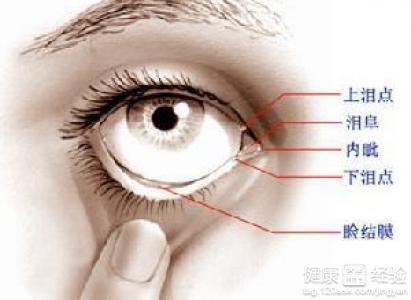 眦部睑緣炎怎麼辦