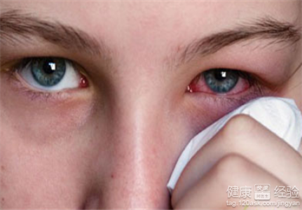 沙眼病危害有哪些呢？如何遠離沙眼困擾