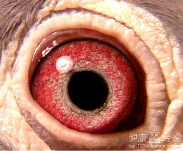 預防沙眼要注意哪些