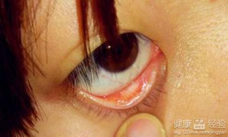 第1步