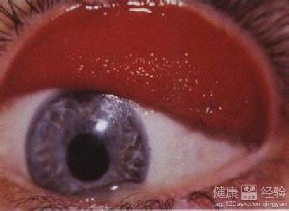 第1步