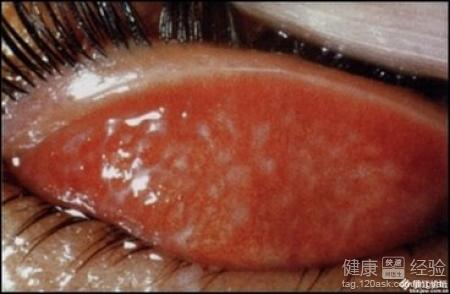 焊接沙眼產生的原因是什麼