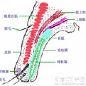 沙眼引發倒睫的臨床表現有哪些