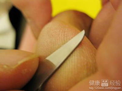 第1步