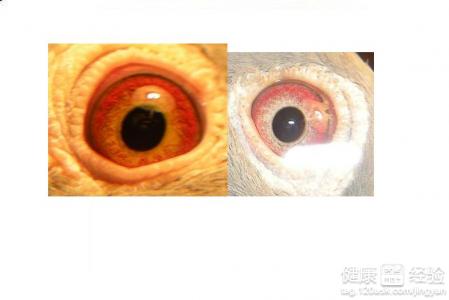 結膜炎是沙眼的症狀之一嗎