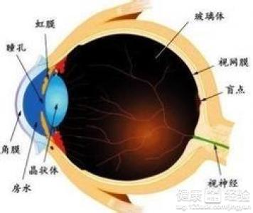 夜盲症怎麼治療