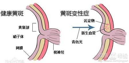 第1步