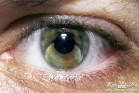 遺傳性視網膜脫落可以治療
