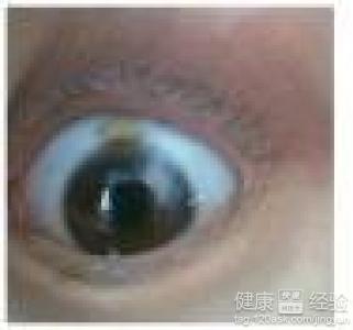 第1步