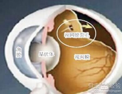 第1步