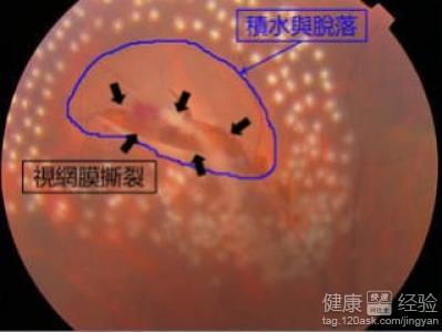 第2步