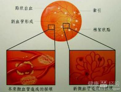 第1步