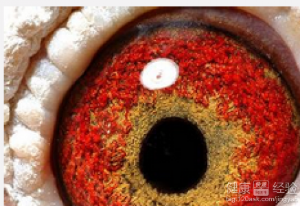 中心性漿液性視網膜病變治療有哪些方法