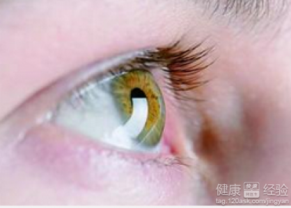 第1步