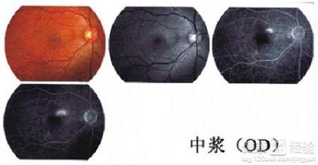 第1步