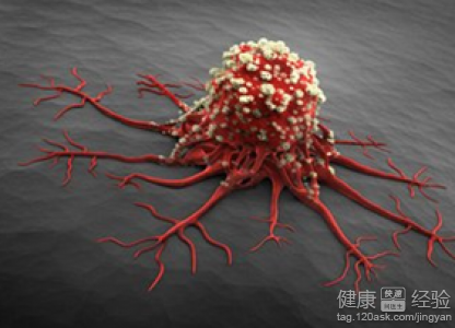 獲得性免疫缺陷綜合征視網膜病變可以吃哪些東西