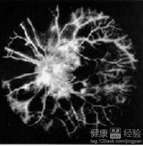 第1步