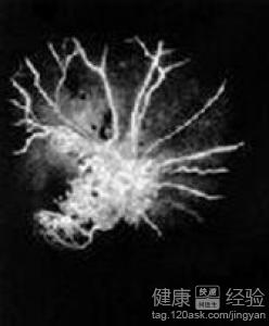 第2步