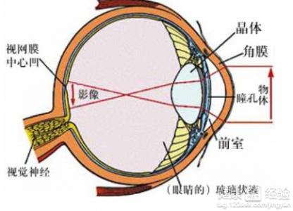 動脈阻塞或狹窄視網膜病變有什麼症狀