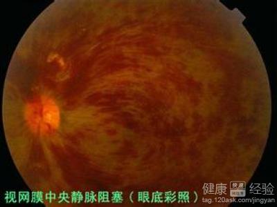 第1步