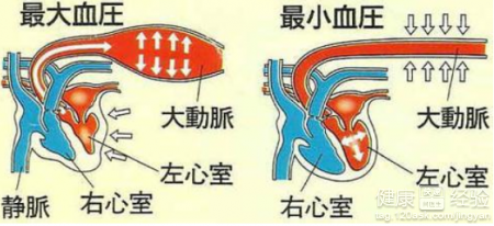 如何治療惡性高血壓視網膜病變