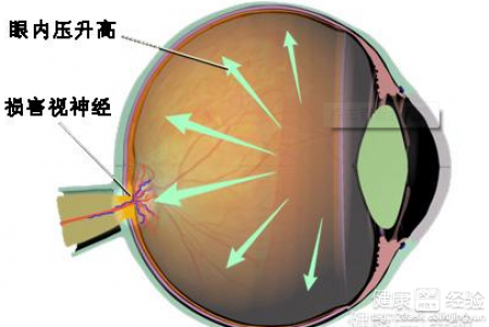 第2步