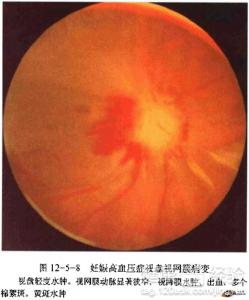 第1步