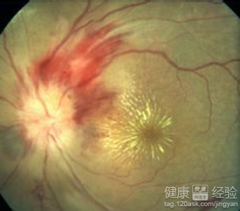 第2步