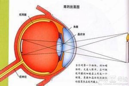 中心性漿液性脈絡膜視網膜病變，左眼視網膜脫離嚴重嗎