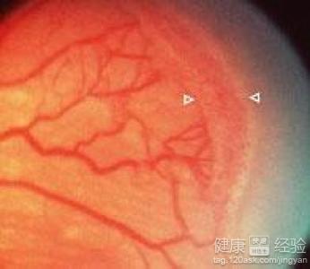 第2步