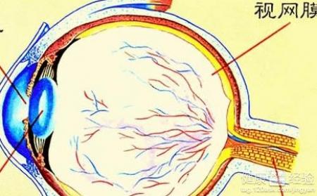 玻璃體視網膜病視網膜脫落怎麼辦