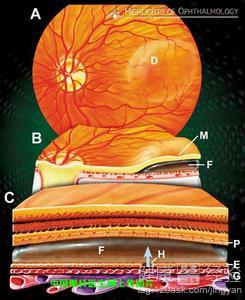 中心槳液性視網膜病變怎麼治