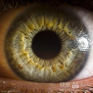 右眼視網膜病視力很低怎麼辦