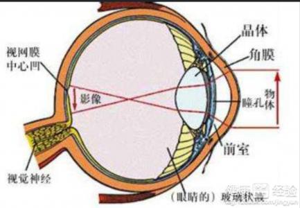如果視網膜病變最大會導致哪些不利因素