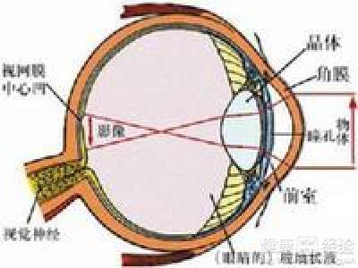 增生性視網膜病變高度近視眼底病變怎樣治療呢