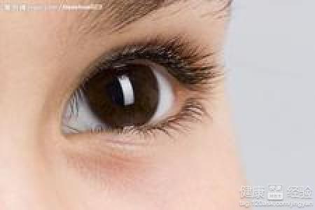 眼睛上的哪些症狀會導致其他疾病